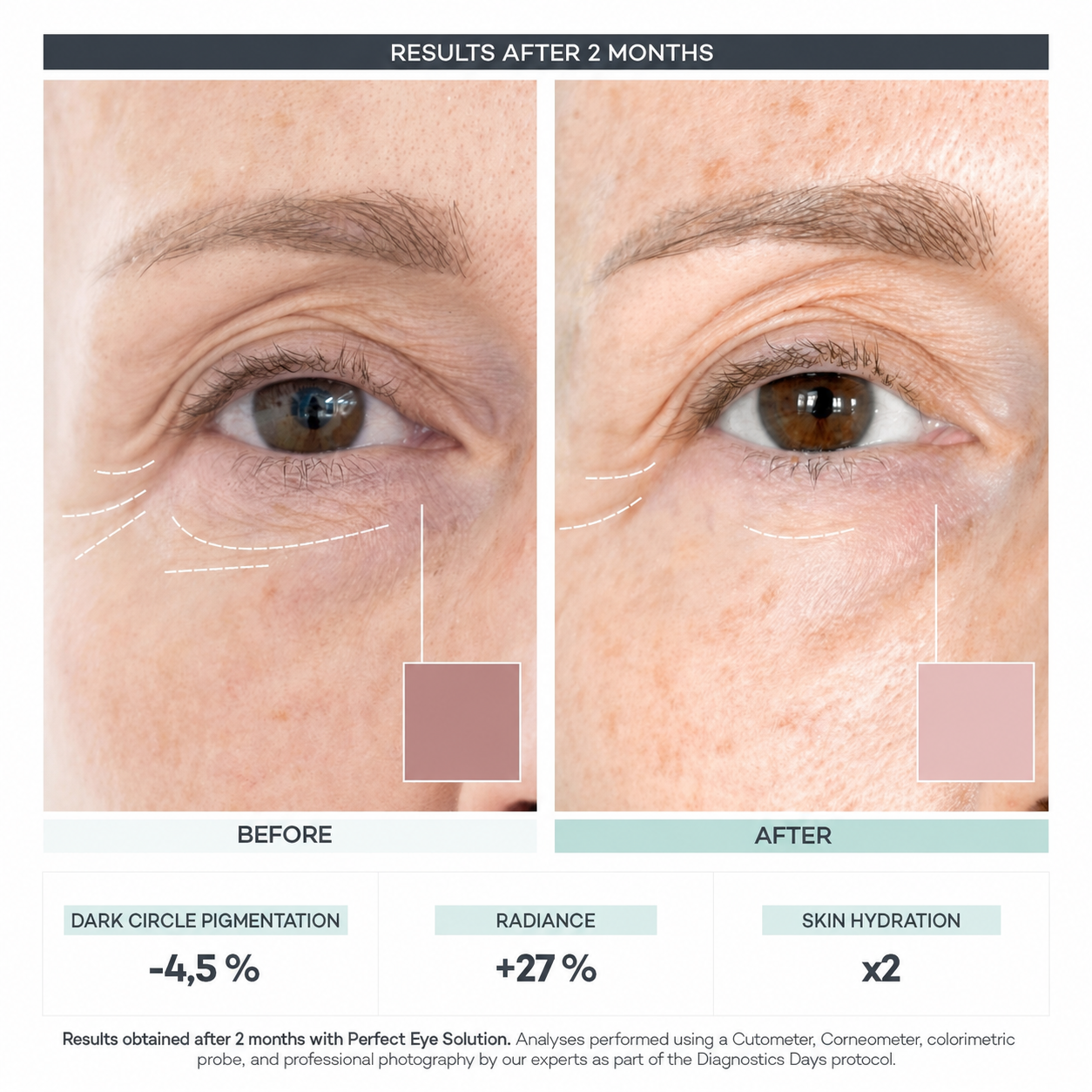 Perfect Eye Contour Complex